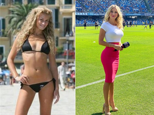 Diletta Leotta antes y después | MCAN Health blog