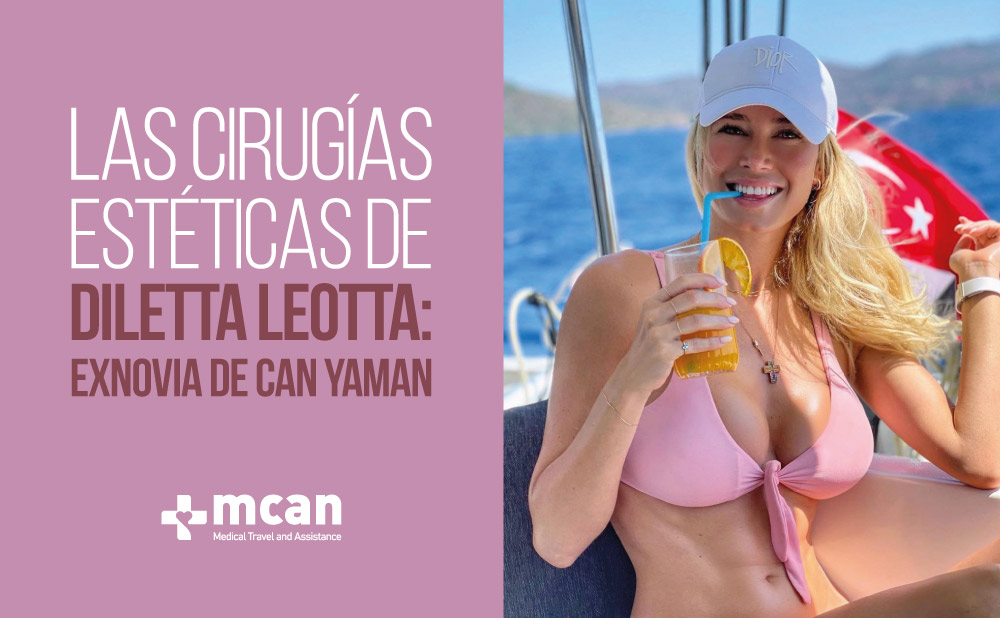 Cirugias estéticas de Diletta Leotta | MCAN Health Blog