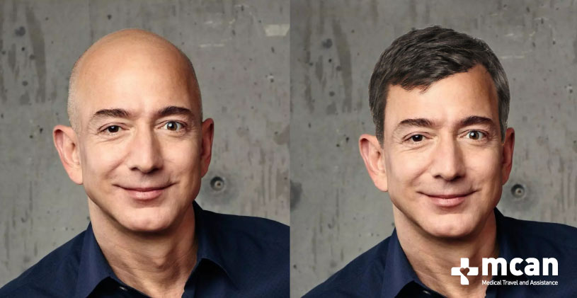 Jeff Bezos With Hair vs Jeff Bezos bald