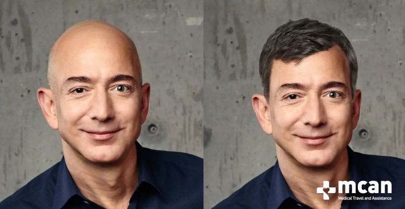 Jeff Bezos With Hair: How Would He Look After a Hair Transplant? 9 how jeff bezos with hair look like Jeff Bezos With Hair vs Jeff Bezos bald