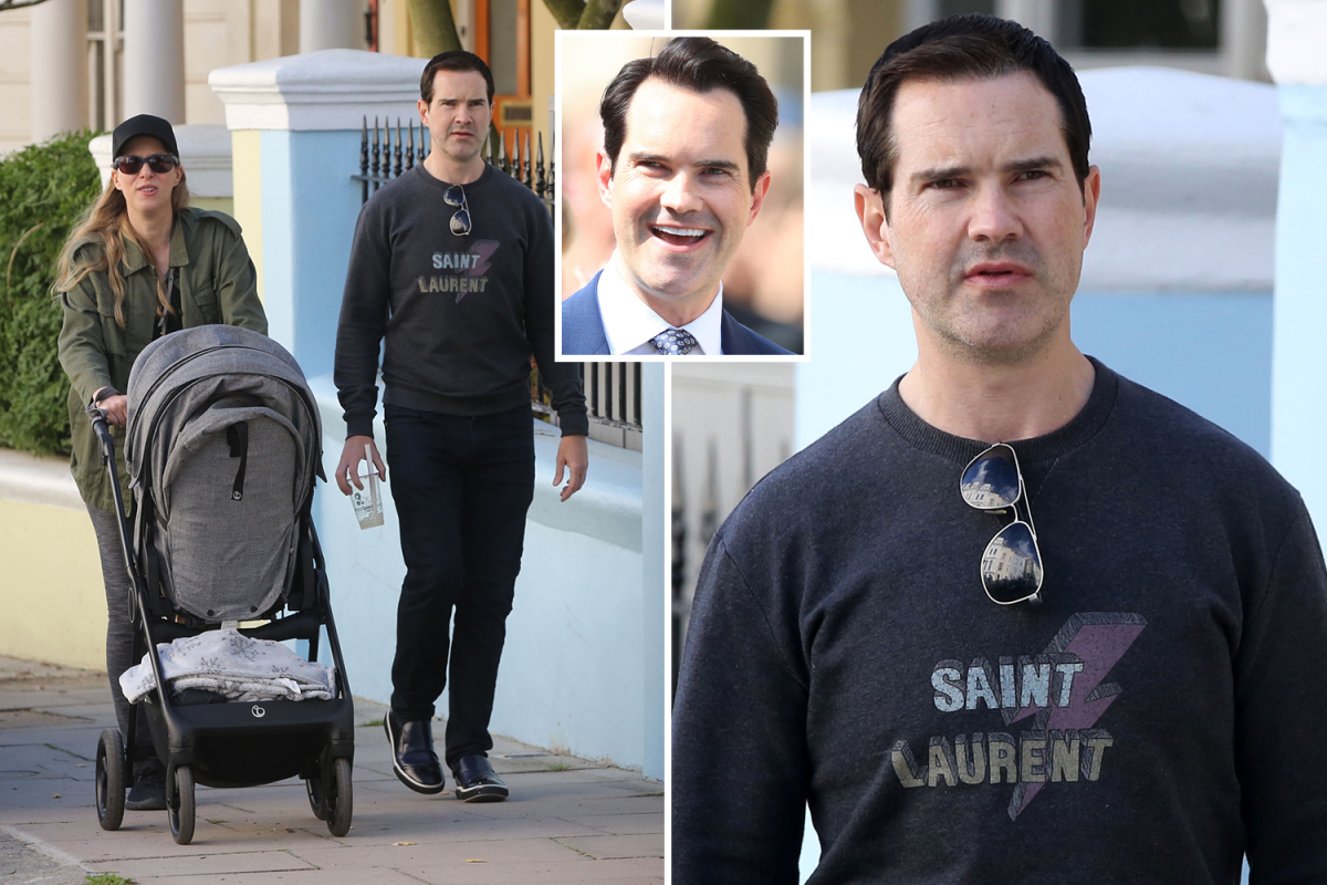 Jimmy Carr after hair transplant and face lift