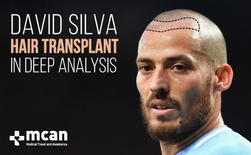 David Silva blog buyuk