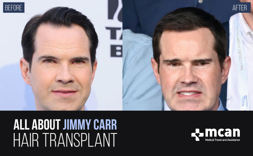 All About Jimmy Carr