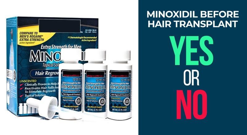 Minoxidil before hair transplant yes or no 