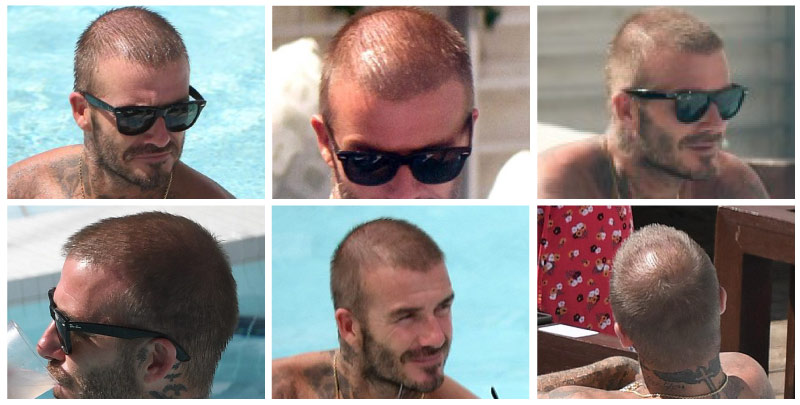David Beckham Hair Loss photo in swimming pool 