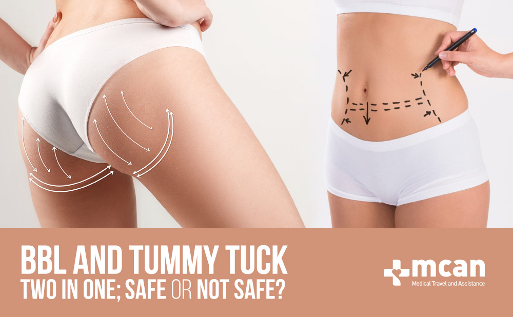 Can you have bbl and tummy tuck at the same time