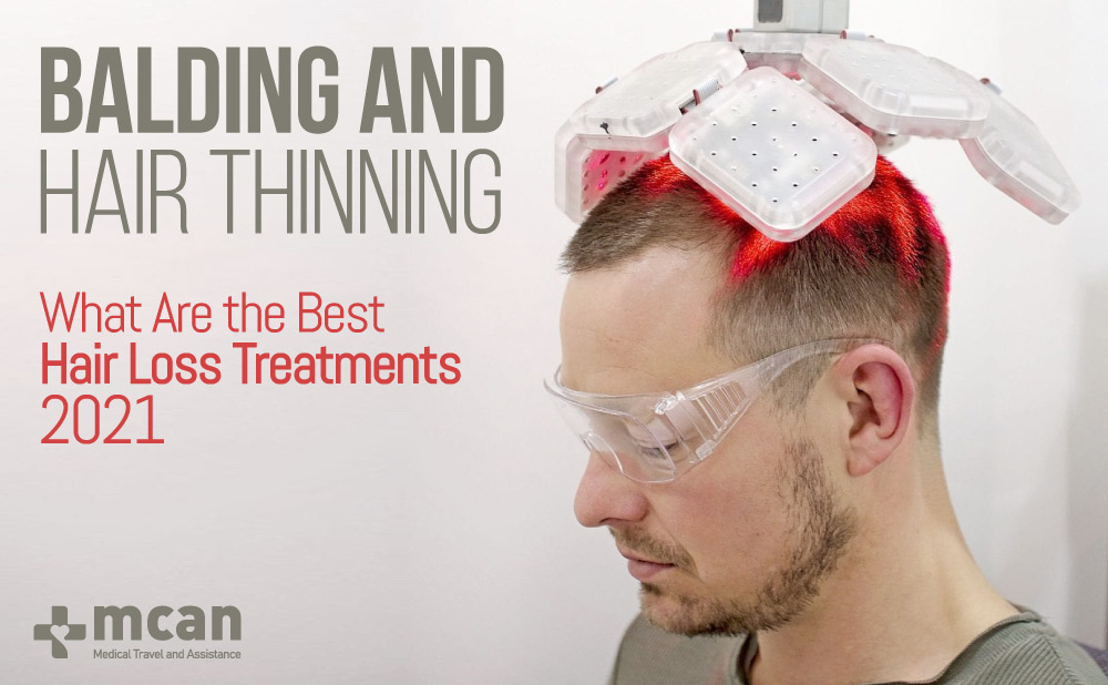 Balding and Hair Thinning, What Are the Best Hair Loss Treatments 2021