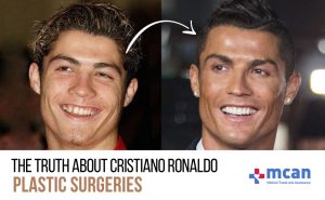 CR7 KAPAK