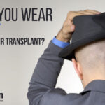 Can You Wear a Hat After Hair Transplant?