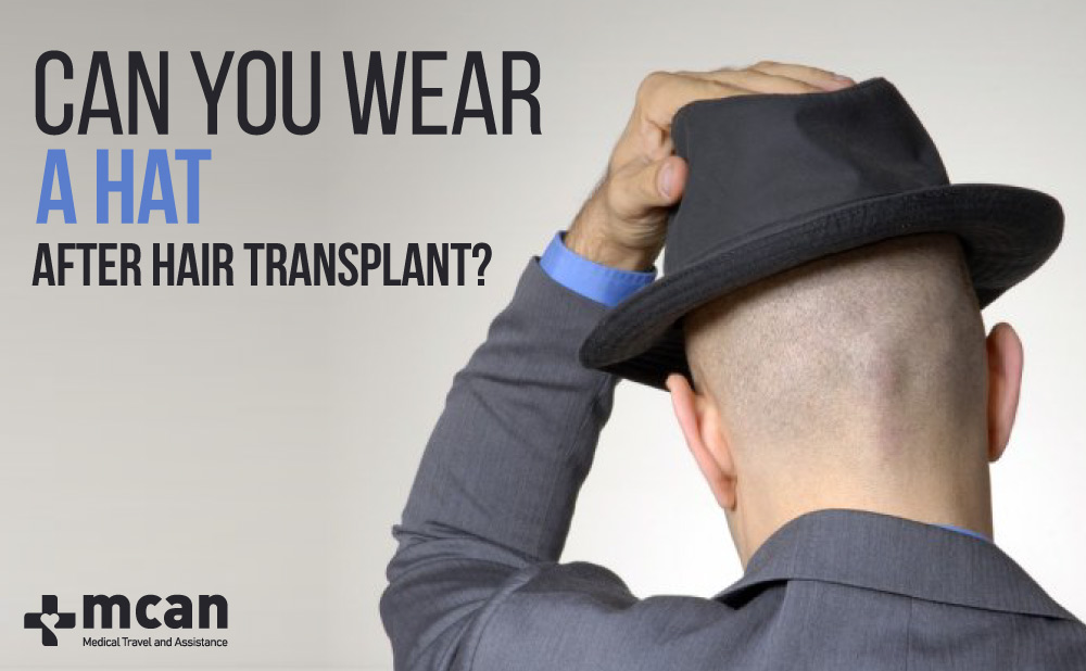 Can You Wear a Hat After Hair Transplant?