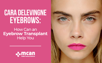 Cara Delevingne Eyebrows | MCAN Health Blog
