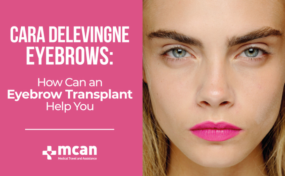 Cara Delevingne Eyebrows