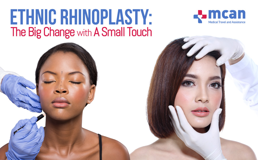 ETHNIC RHINOPLASTY BLOGG COVER