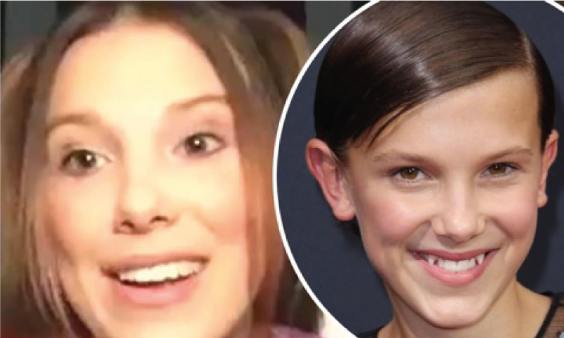 Everything you need to know about Hollywood Smile 2 Hollywood Smile GORSEL1 Hollywood smile before and after