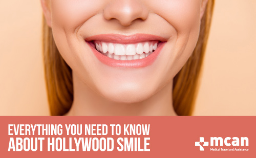All about Hollywood Smile | Dental treatments in Turkey | MCAN Health Blog