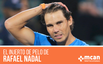 El trasplante capilar de Rafa Nadal | MCAN Health