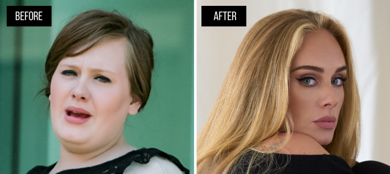 Adele before weight loss surgery