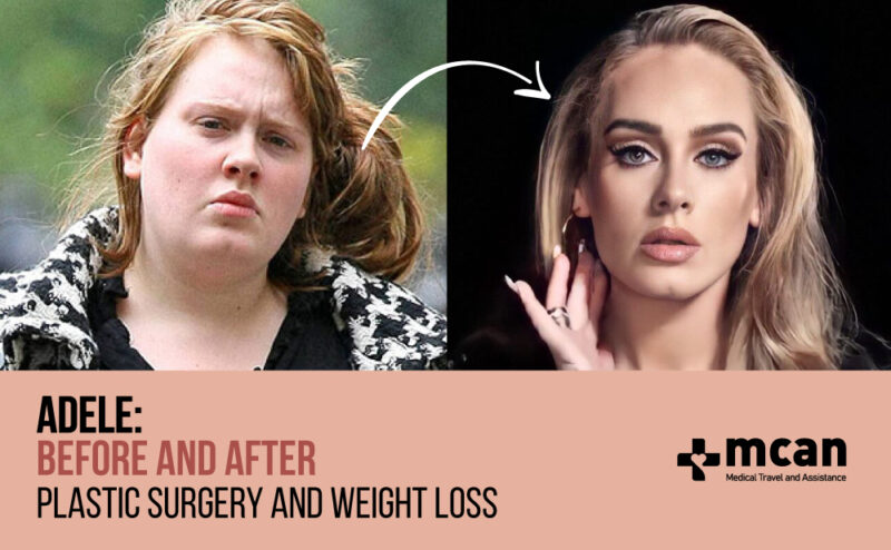 Before and After Adele Body and Face Transformation