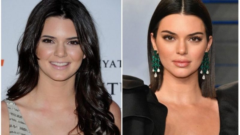 Kendall Jenner Nose Job