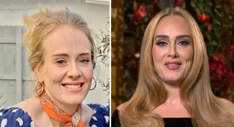 Adele's skin after weight loss