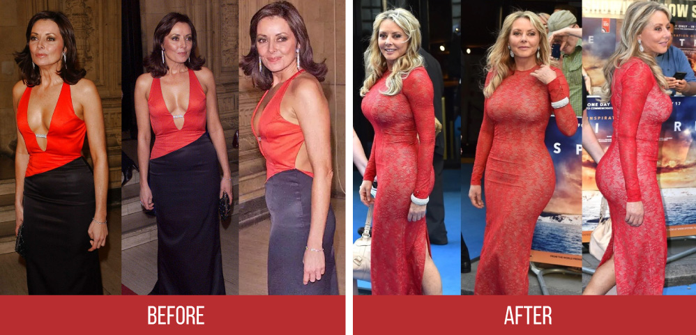 The Truth of Carol Vorderman Plastic Surgery 7 carol vorderman beforeafter1 Carol Vorderman Before and After Plastic Surgeries