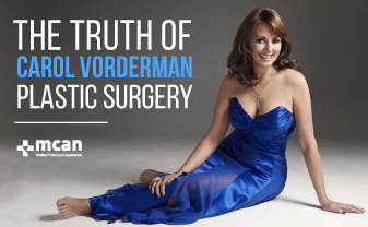 Carol Vorderman Plastic Surgeryes Analysis | MCAN Health Turkey