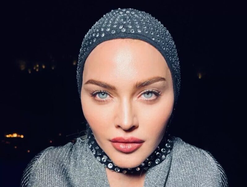 Madonna Plastic Surgery in 2022