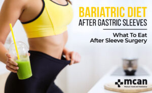 Bariatric Diet After Gastric Sleeves