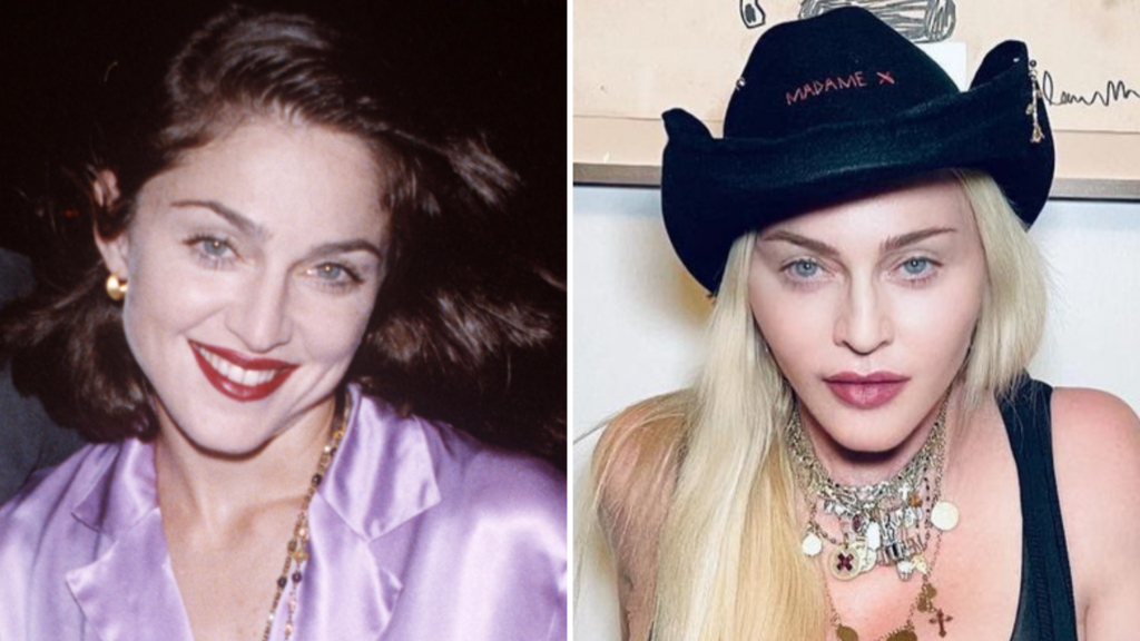 Madonna Plastic Surgery Transformation New Feature