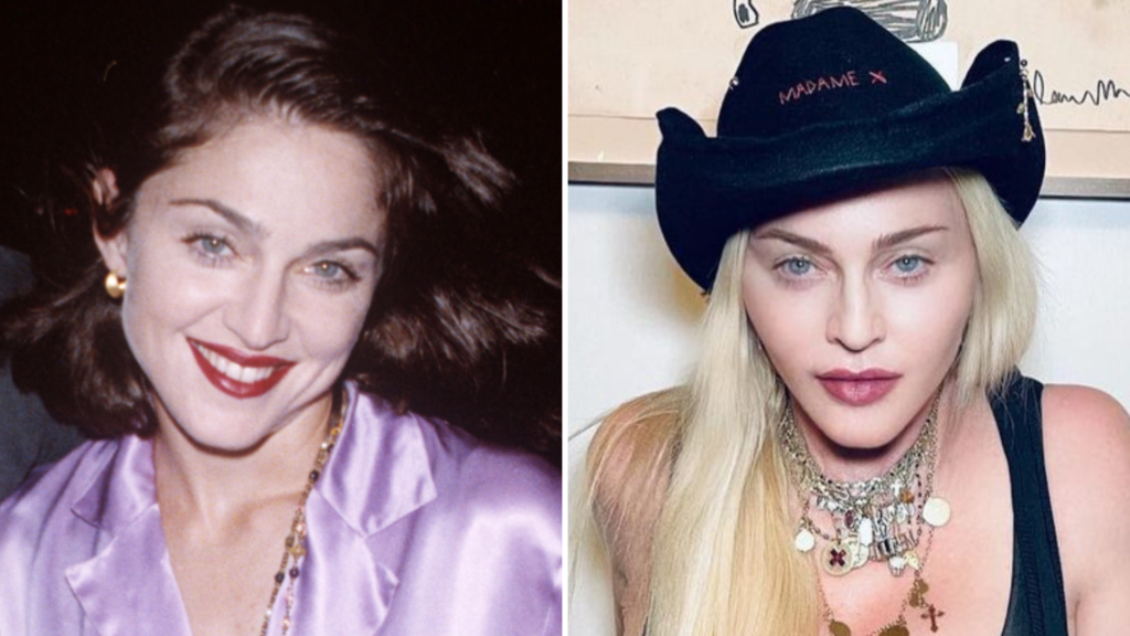 Like a Virgin: Madonna Plastic Surgery 10 Madonna Plastic Surgery Transformation New Feature Madonna Plastic Surgery Transformation New Feature