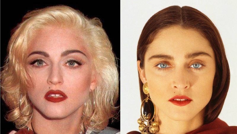 Like a Virgin: Madonna Plastic Surgery 8 Madonna brow lift Madonna Brow Lift