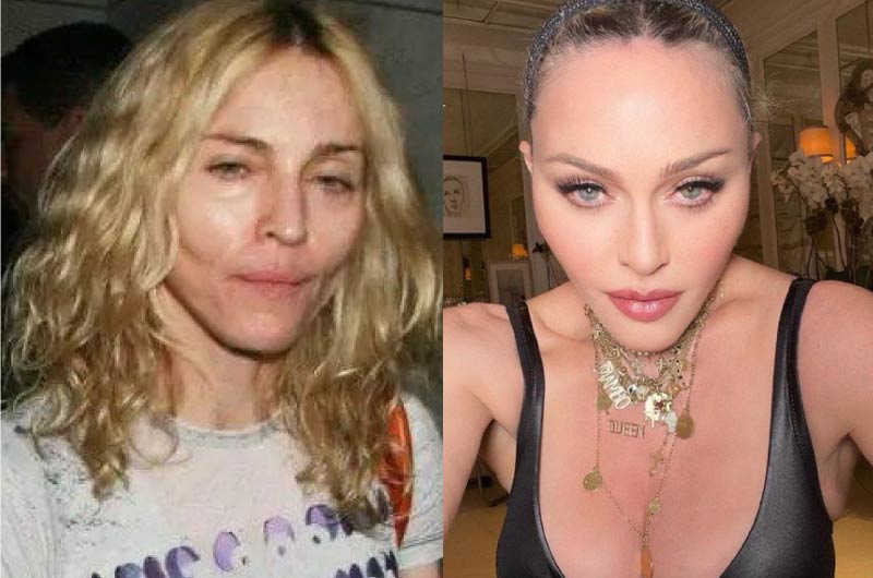 Madonna now and then