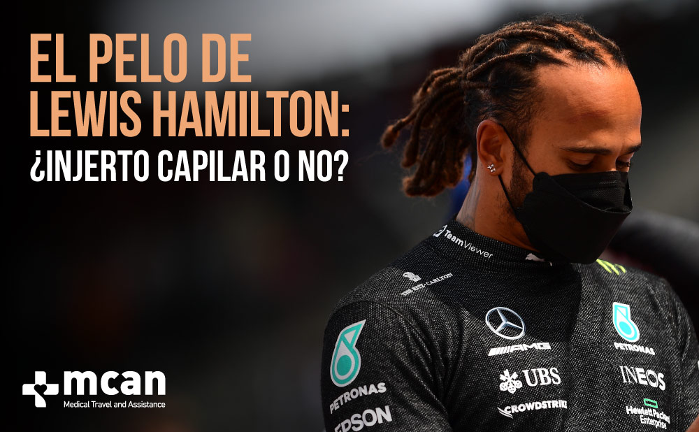 El pelo de Lewis Hamilton: ¿injerto capilar o no?