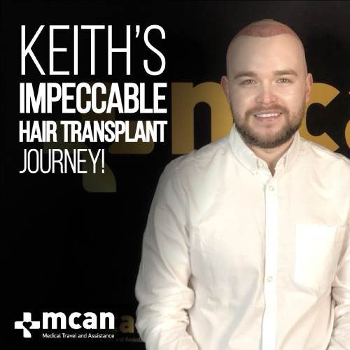 Hair Transplant Video Review 3