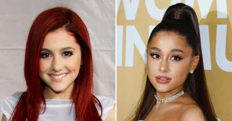 What is True in Ariana Grande Plastic Surgery Speculation? 8 Ariana Grande Lip Fillers e1648126802558 Ariana Grande Plastic Surgery