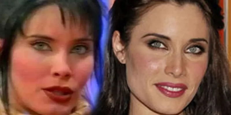 Pilar Rubio antes y después de su rinoplastia