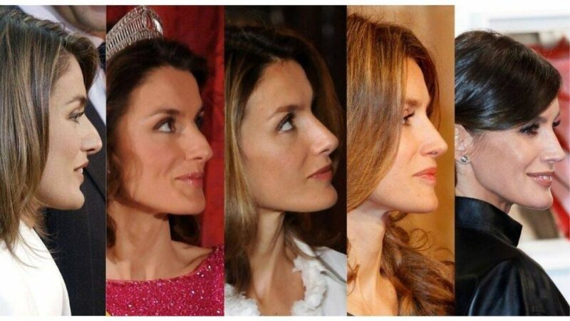 La Reina Letizia antes y después de sus presuntas cirugías 6 Reina Letizia Antes y Despues Rinoplastia e1646749534806 Reina Letizia antes y después de su rinoplastia