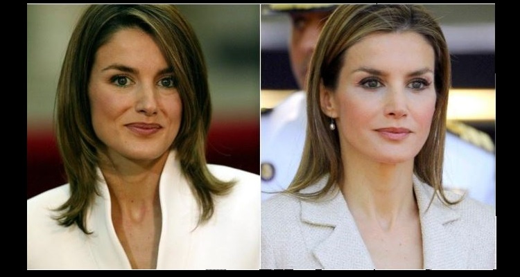 La Reina Letizia antes y después de sus presuntas cirugías 7 Reina Letizia Mentoplastia Reina Letizia antes y después de su mentoplastia