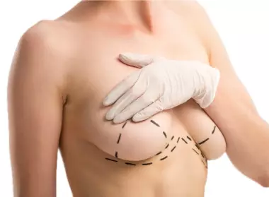 Что такое подтяжка груди в Турции?