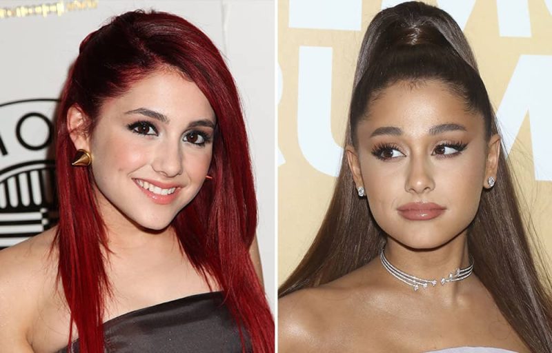 What is True in Ariana Grande Plastic Surgery Speculation? 7 ariana grande brow lift 2 e1648126762880 Ariana Grande Plastic Surgery