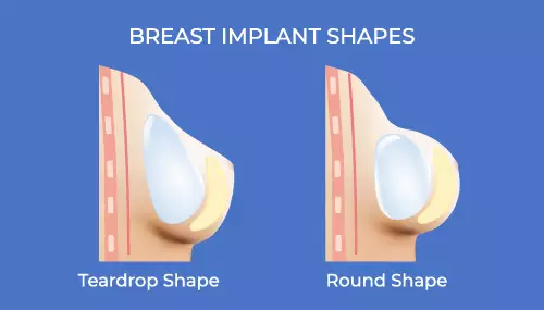 different Shapes for Breast Augmentation Turkey