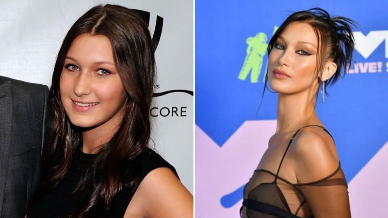 Bella Hadid antes y después de su rinoplastia