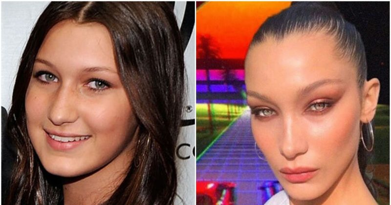 Bella Hadid antes y después de sus operaciones 6 Bella Hadid Blefaroplastia e1651138008627 Bella Hadid antes y después de su blefaroplastia