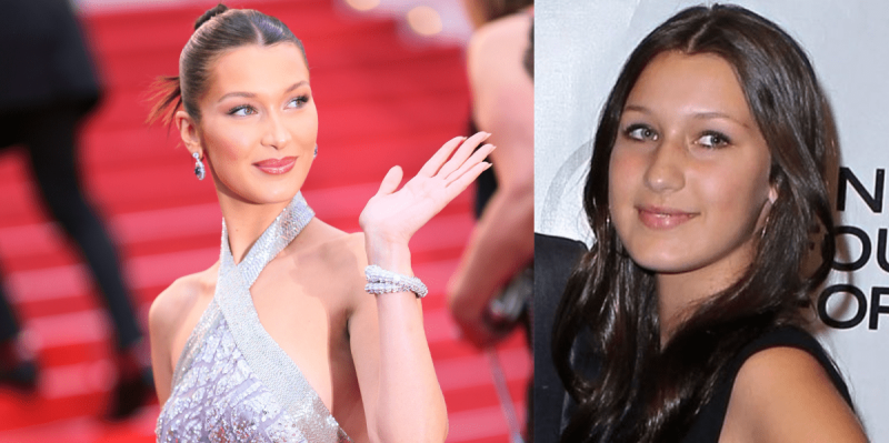 Bella Hadid antes y después de sus operaciones 7 Bella Hadid Filler Labios 1 e1651138400440 Bella Hadid comparación de labios
