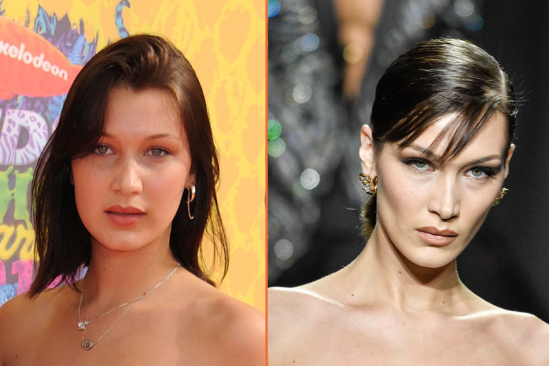 Bella Hadid antes y después de sus operaciones 5 Bella Hadid Filler Labios e1651137885236 Bella Hadid antes y después filler de pómulos