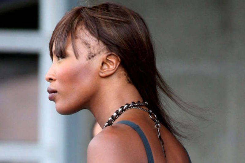 Naomi Campbell pierde mucho cabello