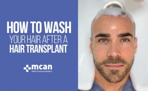 Hair wash after hair transplant