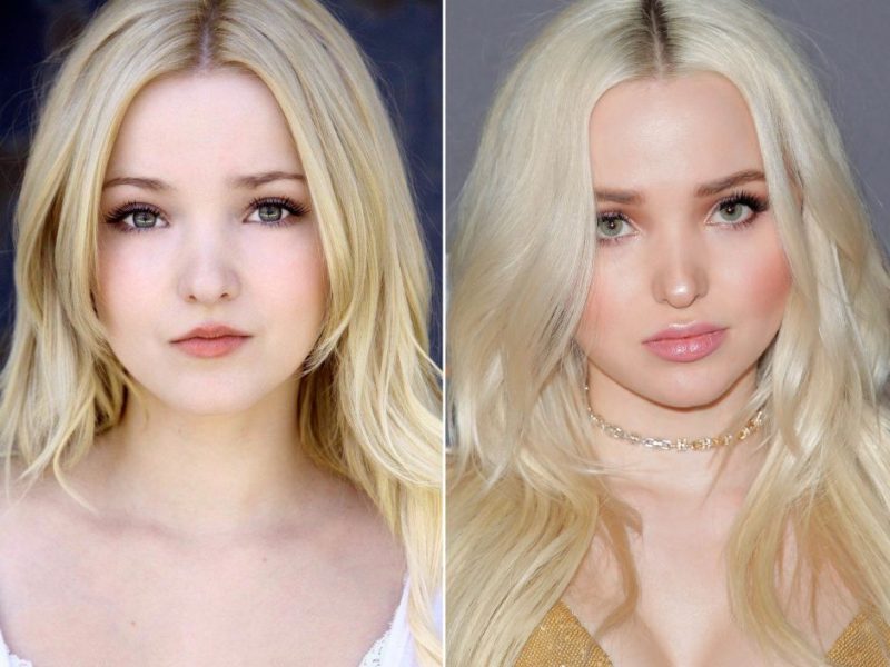Dove Cameron Before and After Picture