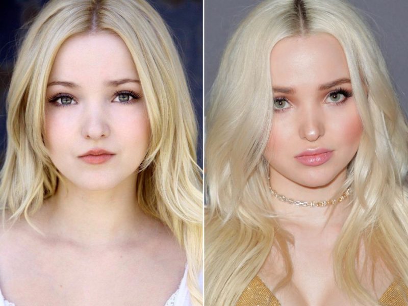 Dove Cameron Before and After Picture Dove Cameron Before and After Picture