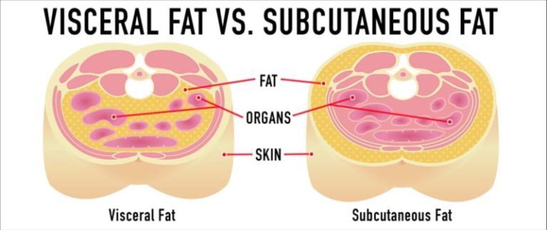 Intramuscular Fat Vs Subcutaneous Fat How to Lose Belly Fat Like an Absolute Champion | MCAN Health Blog